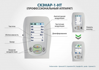 СКЭНАР-1-НТ (исполнение 01)  в Фрязине купить Медицинская техника - denasosteo.ru 